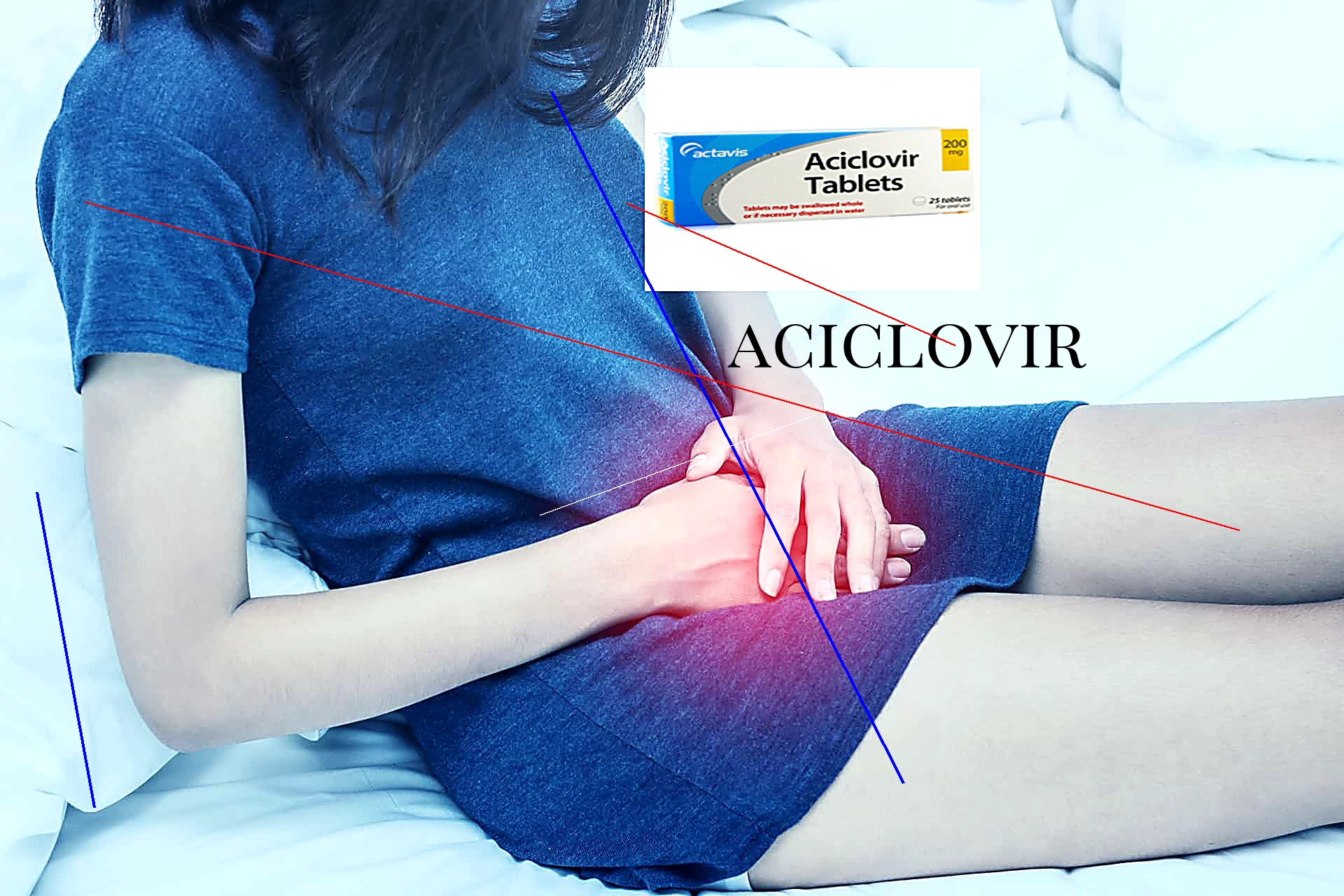 Aciclovir en ligne